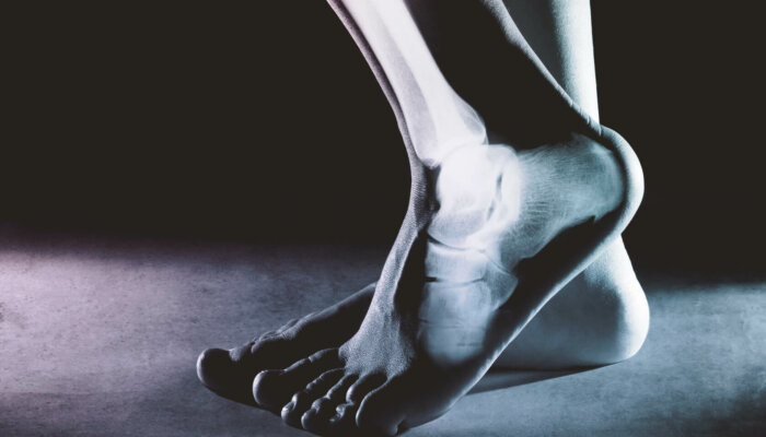 Biolayne - Ankle Mobility