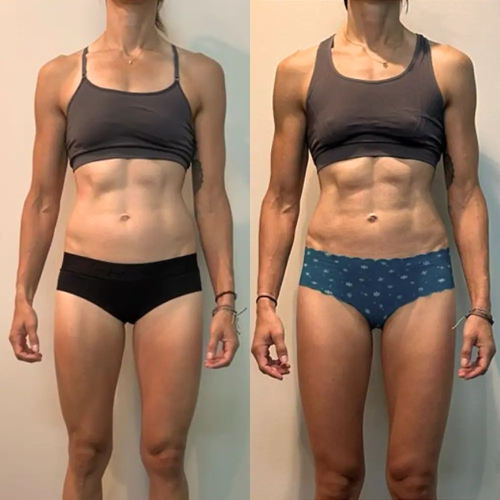 Client - Team Biolayne | Before/After